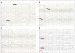 Abb. 1: Epilepsie