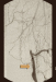Abb. 5: Arteria femoralis - Verschluss