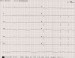 Aktuelles Bild - Abb. 1: Bradykardie - Metabolische Azidose