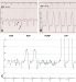 Abb. 1: PC- Invasive Hmodynamik