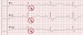 Aktuelles Bild - Abb. 2: EKG