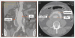 Aktuelles Bild - Abb. 1a-b: CT-Angiographie