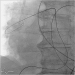 Abb. 1: Arteria pulmonalis