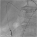 Aktuelles Bild - Abb. 2: Arterio-vense Verbindung