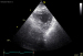 Abb. 2a: Echo