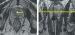 Abb. 7: MRT