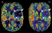 Abb. 5: MR-Perfusion
