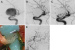 Abb. 4: Angiogramme