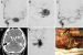 Abb. 5a-f: Angiogramme