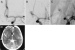 Abb. 7: Angiogramme