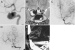 Abb. 9a-e: Angiogramme