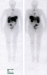 Abb. 2: SPECT