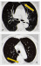 Aktuelles Bild - Abb. 2a-b: Nierentumor