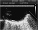 Abb. 2: Aorta thoracalis