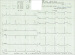 Abb. 1: EKG