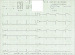 Abb. 2: EKG