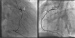 Aktuelles Bild - Abb. 3: Angiographie