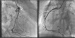 Abb. 4: Angiographie