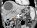 Aktuelles Bild - Abb. 1a: MDCT