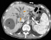Abb. 1b: MDCT