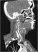Abb. 6: CT-Angiographie