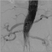 Abb. 2: Angiogramm