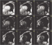 Abb. 6: Cardiac MR