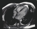 Abb. 8: Cardiac MR