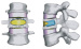 Abb. 3: FEM-Stimulation