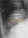 Abb. 1: TH11