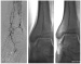 Abb. 2: A. dorsalis pedis - A. plantaris pedis