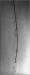 Abb. 4: Katheter