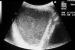 Abb. 1a: Sonographie