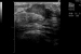 Aktuelles Bild - Abb. 1b: Sonographie