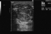 Abb. 1c: Sonographie