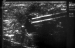 Abb. 2: Sonographie