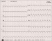 Abb. 1: Hyperkalimie