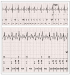 Aktuelles Bild - Abb. 3: EKG