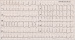 Abb. 1: EKG