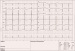 Abb. 2: EKG