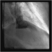 Aktuelles Bild - Abb. 6: Ventrikulogramm