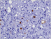 Aktuelles Bild - Abb. 8: Grand-mal-Anfall