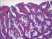 Abb. 1: Polyp