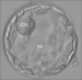 Abb. 1: Blastocyst - Hatching