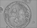 Abb. 6: Trophoblast vesicle