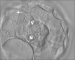 Abb. 5: Inner cell mass