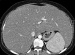Aktuelles Bild - Abb. 1a: MDCT