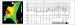 Abb. 1: Katheterablation
