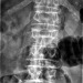 Abb. 1: Lumbar vertebra