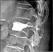 Abb. 4: Lumbar vertebra